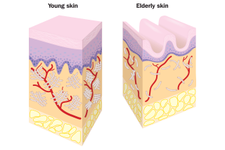 Young and elderly skin
